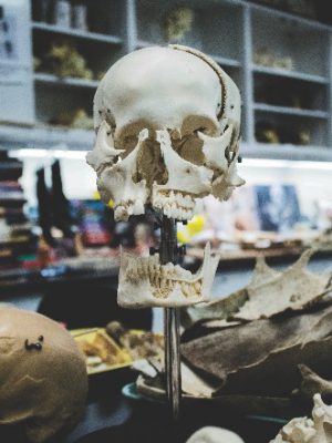 De schedel van dieren en mensen bestaan uit verschillende schedelbotten die ten opzichte van elkaar minimaal kunnen bewegen.